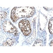 CABYR Rabbit Polyclonal Antibody (12351-1-AP)
