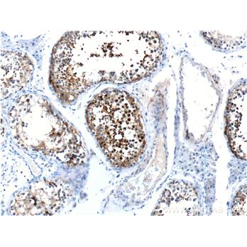 CABYR Rabbit Polyclonal Antibody (12351-1-AP)