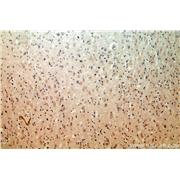 PRMT8 Rabbit Polyclonal Antibody (12557-1-AP)