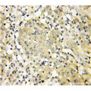 UBE2C Rabbit Polyclonal Antibody (12134-2-AP)