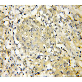 UBE2C Rabbit Polyclonal Antibody (12134-2-AP)
