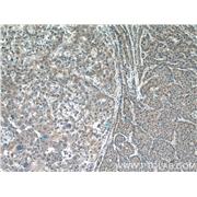 IMP5 Rabbit Polyclonal Antibody (12664-1-AP)