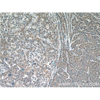 IMP5 Rabbit Polyclonal Antibody (12664-1-AP)