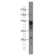 SHPK Rabbit Polyclonal Antibody (12441-1-AP)