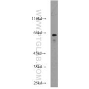 MAP3K7 Rabbit Polyclonal Antibody (12330-2-AP)