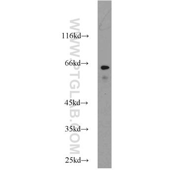 MAP3K7 Rabbit Polyclonal Antibody (12330-2-AP)