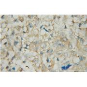 PDE1A Rabbit Polyclonal Antibody (12442-2-AP)