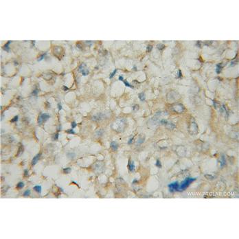 PDE1A Rabbit Polyclonal Antibody (12442-2-AP)