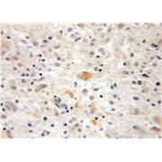 CPOX Rabbit Polyclonal Antibody (12211-1-AP)