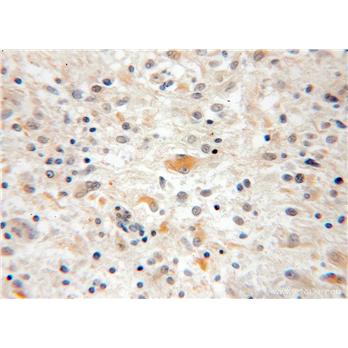 CPOX Rabbit Polyclonal Antibody (12211-1-AP)