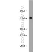 STAM Rabbit Polyclonal Antibody (12434-1-AP)