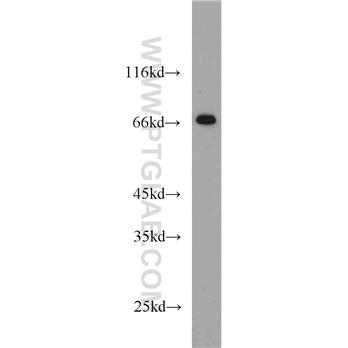 STAM Rabbit Polyclonal Antibody (12434-1-AP)