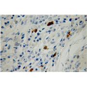 SMG5 Rabbit Polyclonal Antibody (12694-1-AP)