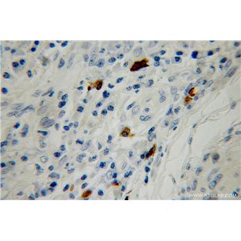 SMG5 Rabbit Polyclonal Antibody (12694-1-AP)