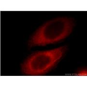 RAB3IP Rabbit Polyclonal Antibody (12321-1-AP)
