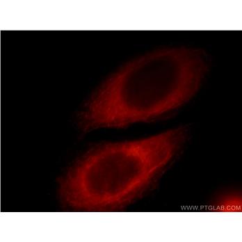 RAB3IP Rabbit Polyclonal Antibody (12321-1-AP)