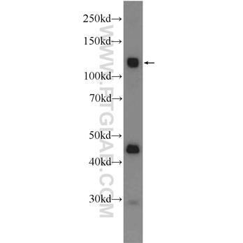 CDCP1 Rabbit Polyclonal Antibody (12754-1-AP)