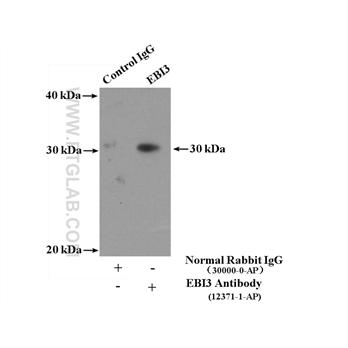 EBI3 Rabbit Polyclonal Antibody (12371-1-AP)