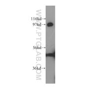 MATR3 Rabbit Polyclonal Antibody (12202-2-AP)