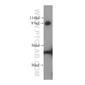 MATR3 Rabbit Polyclonal Antibody (12202-2-AP)