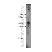 TRIM25 Rabbit Polyclonal Antibody (12573-1-AP)