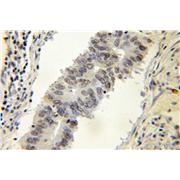 DNAJC1 Rabbit Polyclonal Antibody (12362-1-AP)