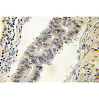 DNAJC1 Rabbit Polyclonal Antibody (12362-1-AP)