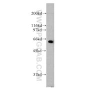 AGFG1 Rabbit Polyclonal Antibody (12670-1-AP)
