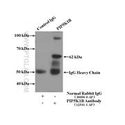 PIP5K1B Rabbit Polyclonal Antibody (12541-1-AP)