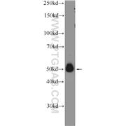 A4GALT Rabbit Polyclonal Antibody (12392-1-AP)