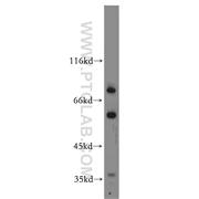SHKBP1 Rabbit Polyclonal Antibody (12703-1-AP)