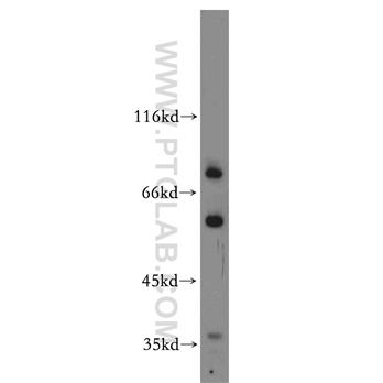 SHKBP1 Rabbit Polyclonal Antibody (12703-1-AP)