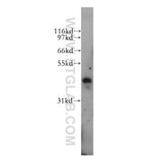 PBX3 Rabbit Polyclonal Antibody (12571-1-AP)