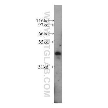 PBX3 Rabbit Polyclonal Antibody (12571-1-AP)