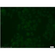 USP3 Rabbit Polyclonal Antibody (12490-1-AP)