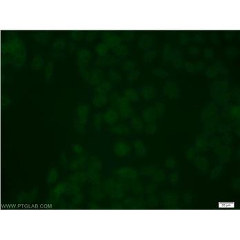 USP3 Rabbit Polyclonal Antibody (12490-1-AP)