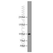 LIG4 Rabbit Polyclonal Antibody (12695-1-AP)