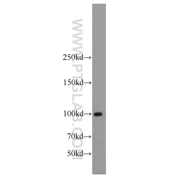 LIG4 Rabbit Polyclonal Antibody (12695-1-AP)