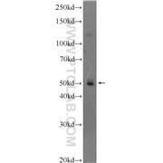 PPP2R2C Rabbit Polyclonal Antibody (12747-1-AP)