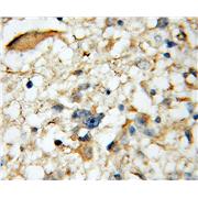 SH3GL2 Rabbit Polyclonal Antibody (12435-1-AP)