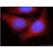 IDH1 Rabbit Polyclonal Antibody (12332-1-AP)