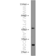 PDK3 Rabbit Polyclonal Antibody (12215-1-AP)