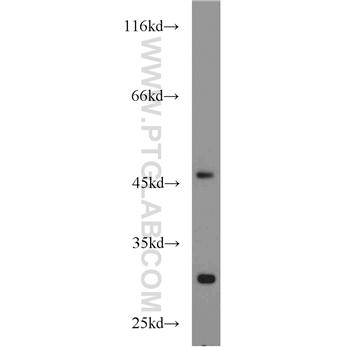 PDK3 Rabbit Polyclonal Antibody (12215-1-AP)