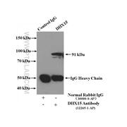 DHX15 Rabbit Polyclonal Antibody (12265-1-AP)
