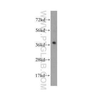 MAP2K6 Rabbit Polyclonal Antibody (12745-1-AP)