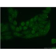 PINX1 Rabbit Polyclonal Antibody (12368-1-AP)