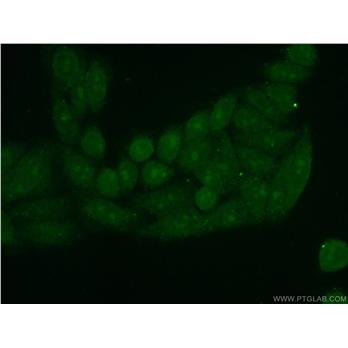 PINX1 Rabbit Polyclonal Antibody (12368-1-AP)