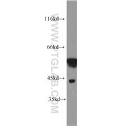 MICA Rabbit Polyclonal Antibody (12619-1-AP)