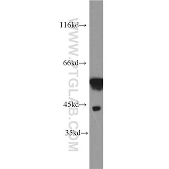 MICA Rabbit Polyclonal Antibody (12619-1-AP)