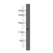 GEMIN6 Rabbit Polyclonal Antibody (12307-2-AP)